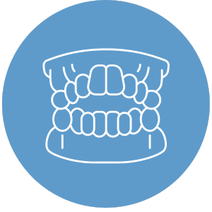 Gingivoplastia