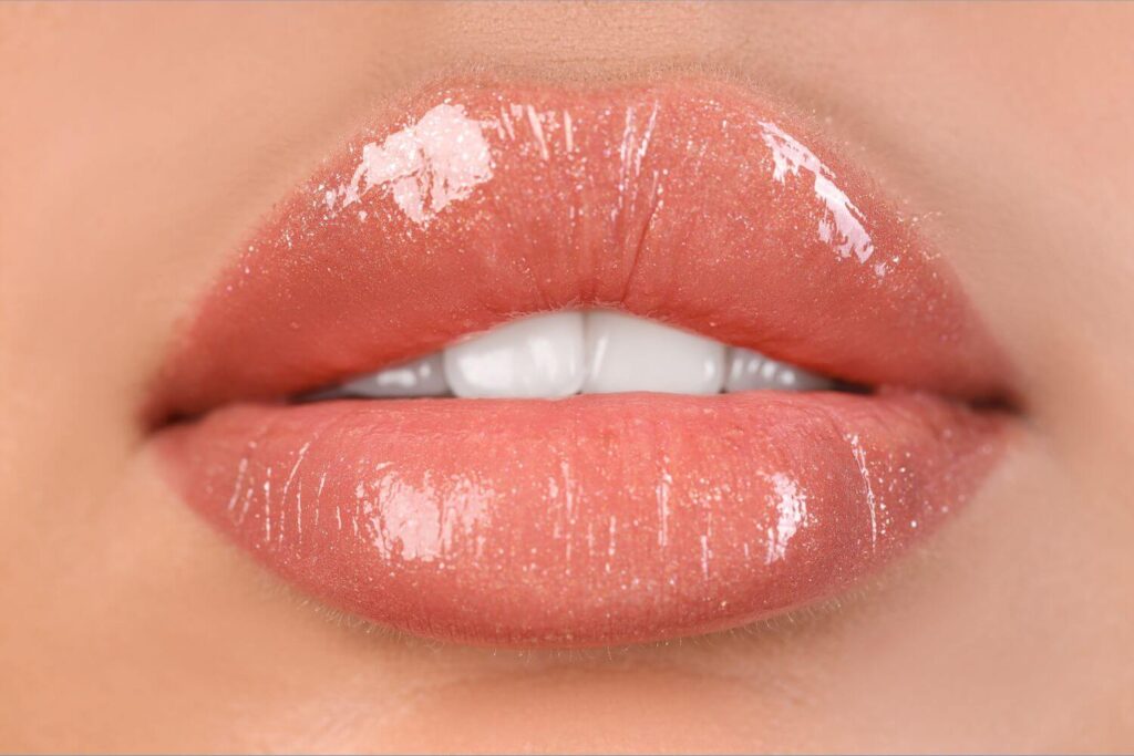 Especialista en labios en GDL 1