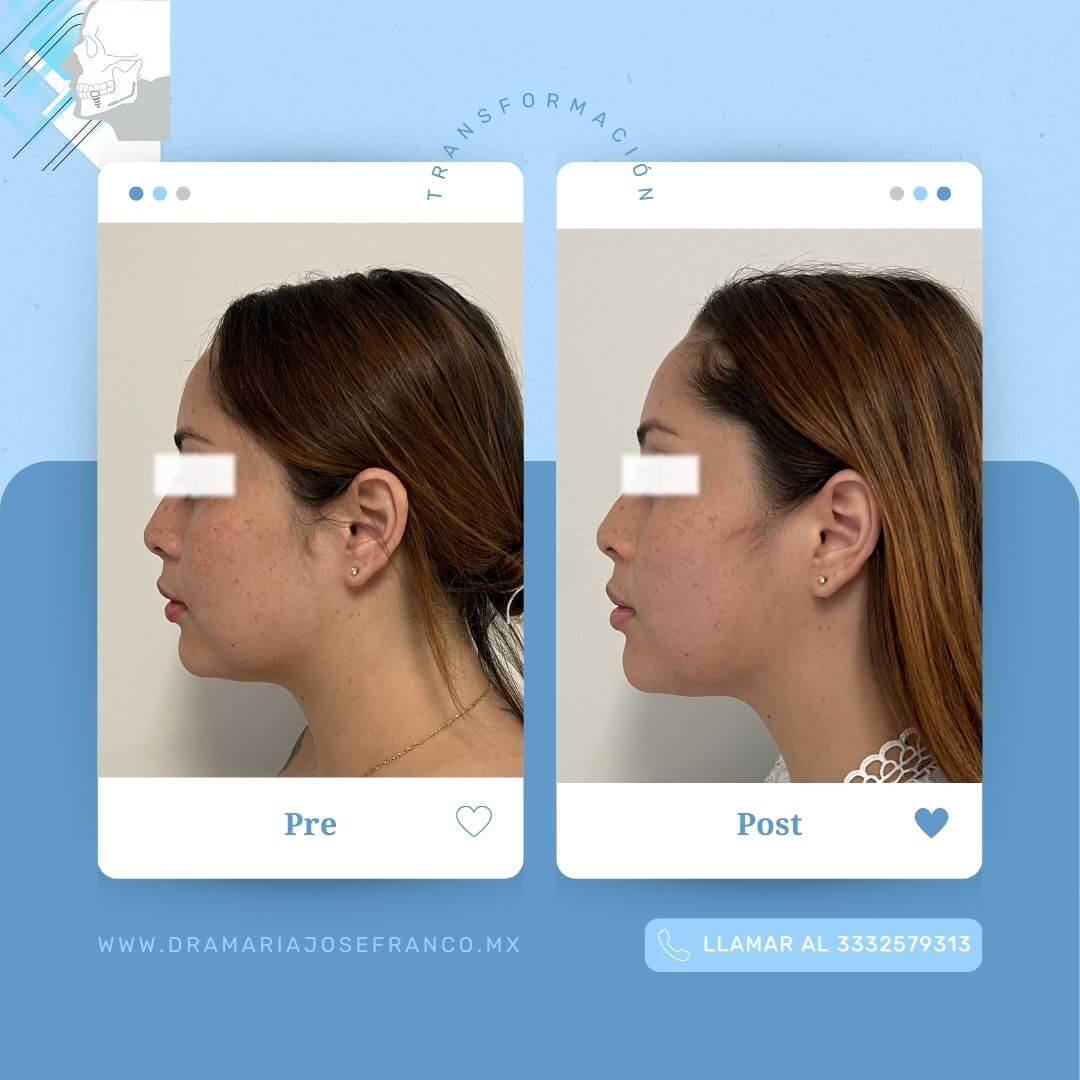LIPOPAPADA 5